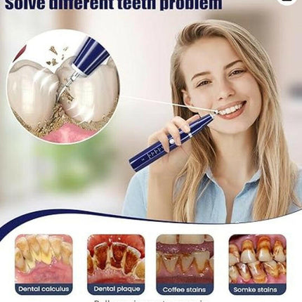 Stop Struggling with Food Stuck in Teeth! This Sonic Cleaner Removes Plaque in 30 Seconds! from Yellow Stains to Sparkling White! Cleansing Oral Removable Multicolor Kit Water Proof Jyq-01-Prilotte Store01